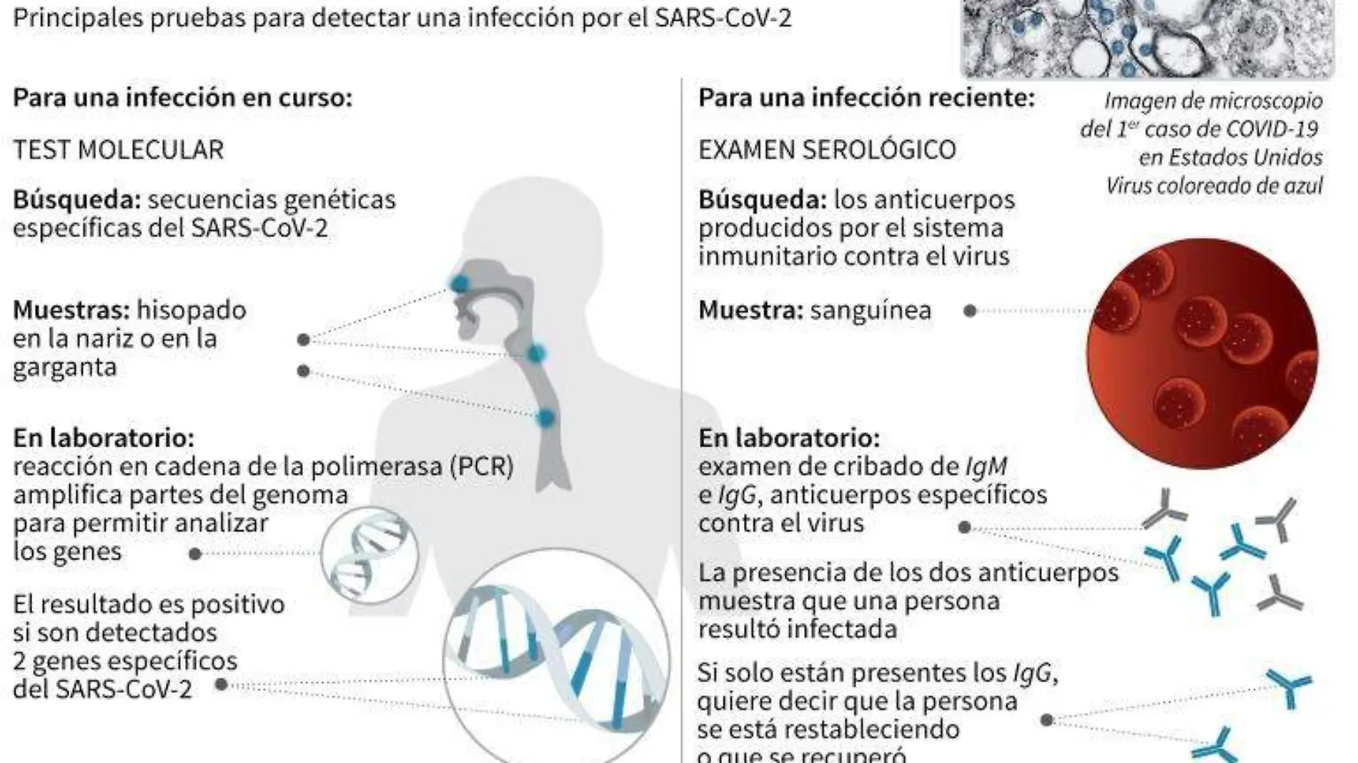 Test para coronavirus